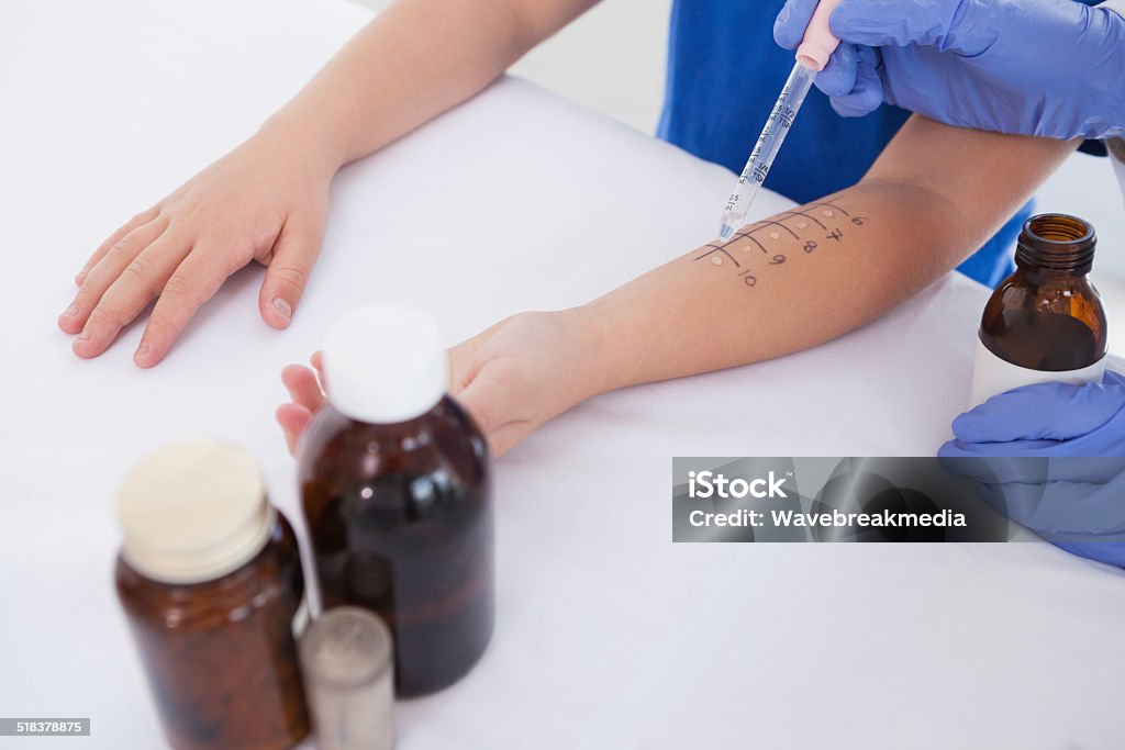 Arzt, ein gewisser Weise test Haut - Lizenzfrei Allergietest Stock-Foto