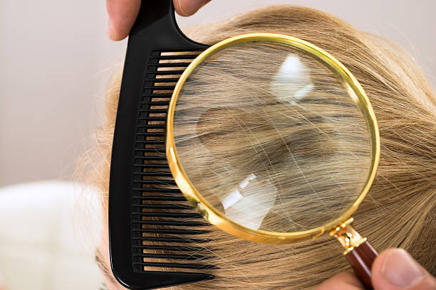 istock Dermatologist Looking Blonde Hair Through Magnifying Glass 518427870