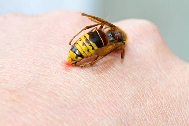 Hornet sting Hornet on a hand sting in the skin stinging photos stock pictures, royalty-free photos & images