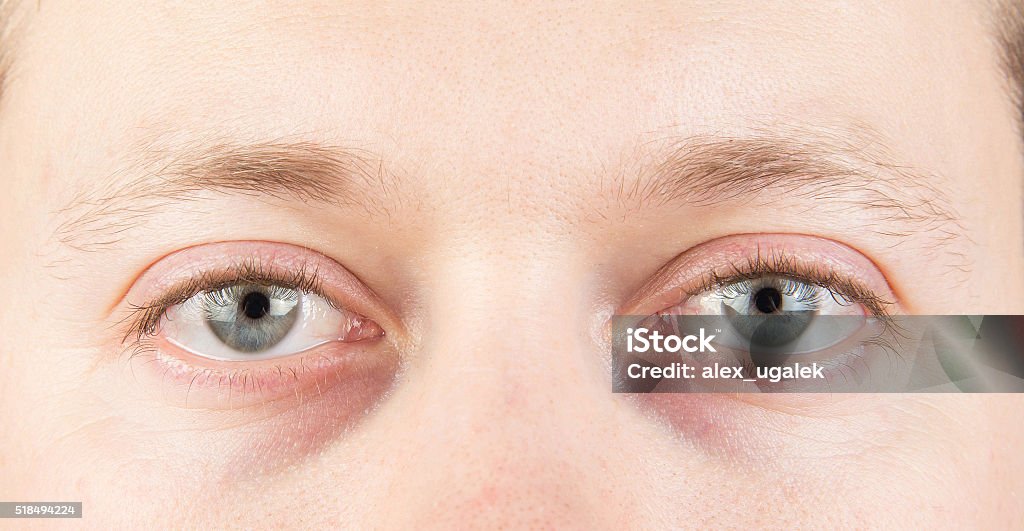 Man's tired eyes Man's tired gray eyes, clean skin Eye Stock Photo