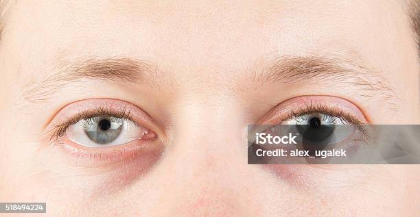 Mans Tired Eyes Stock Photo - Download Image Now - Eye, Dark, Tired