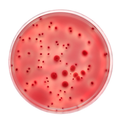 Petri dish with bacteria colonies, isolated on white