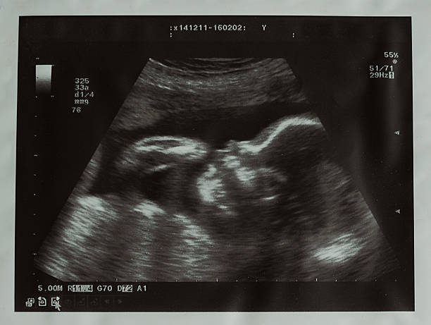 Ultrasound picture of baby Ultrasound picture of baby. Ultrasound scan of a twenty four week old fetus in a profile view lying on its back and sucking finger. Ultrasound of baby in pregnant woman. frequency photos stock pictures, royalty-free photos & images