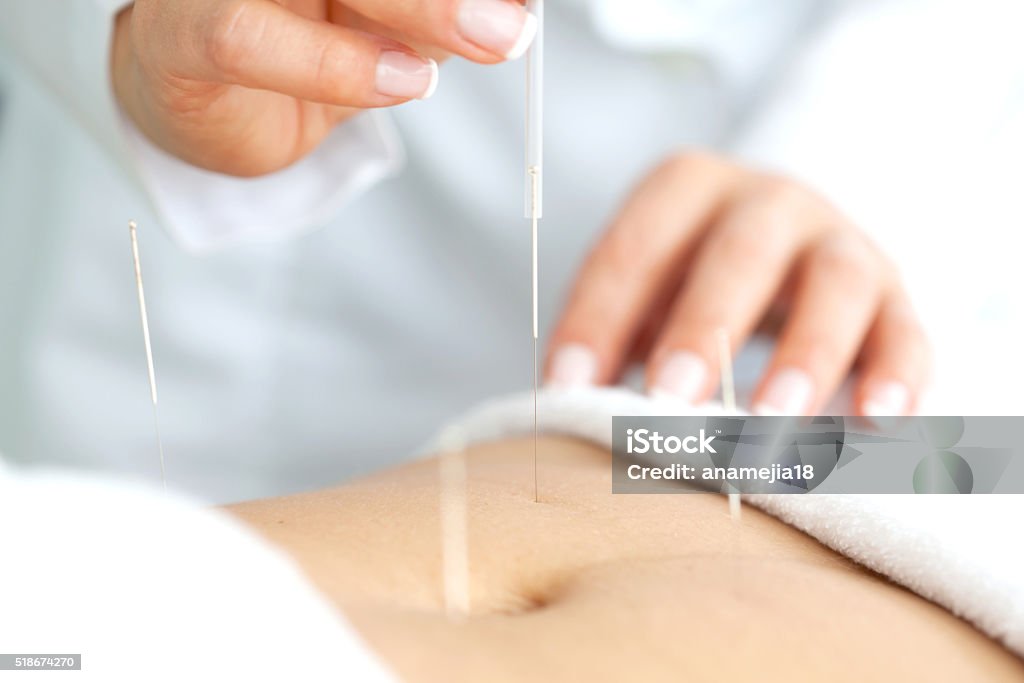 Bauchmuskeln Akupunktur - Lizenzfrei Akupunktur Stock-Foto