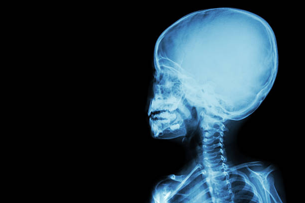 folia rtg czaszki i ciało dziecka - body human spine human head human neck zdjęcia i obrazy z banku zdjęć