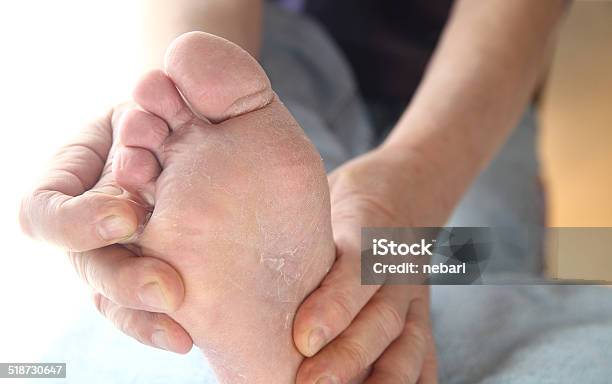 Man With Athletes Foot Itchy Skin Stock Photo - Download Image Now - Athlete's Foot, Human Foot, Scratching