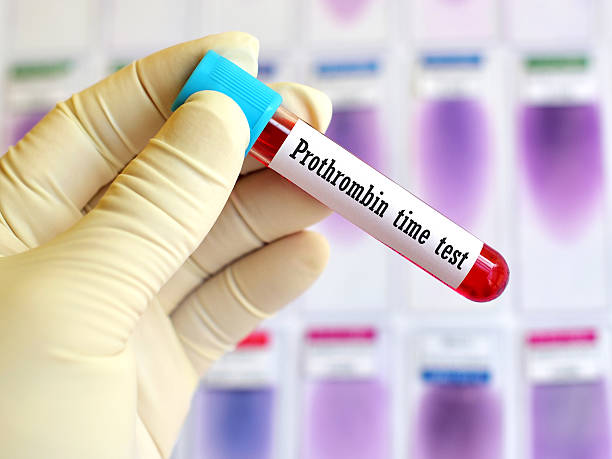 Protime Inr 30+ Thrombin Time Stock Photos, Pictures & Royalty-Free Images - iStock