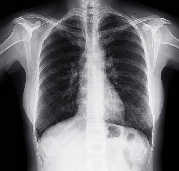 badanie rentgenowskie klatki piersiowej obraz kobiet - human heart x ray image anatomy human internal organ zdjęcia i obrazy z banku zdjęć