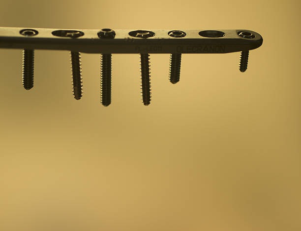 Traumatology orthopedic surgery implant plate and screws Traumatology orthopedic surgery implant plate and screws in semi silhouette against plain studio background. Closeup macro photograph in beige tones. tornillo stock pictures, royalty-free photos & images