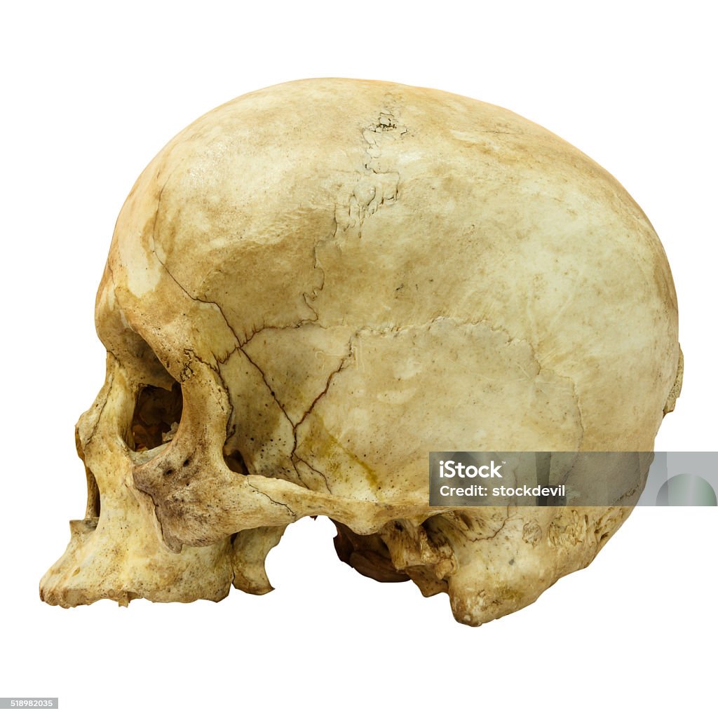 Human Skull Fracture (side)  (Mongoloid,Asian) on isolated background Adult Stock Photo