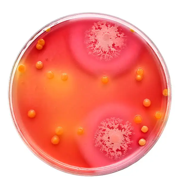 Photo of Bacteria colonies on petri dish with blood agar