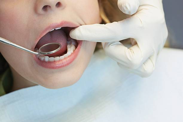 child having a dental examination - mensentong stockfoto's en -beelden