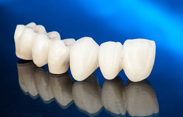 istock Metal free ceramic dental crowns 519182630
