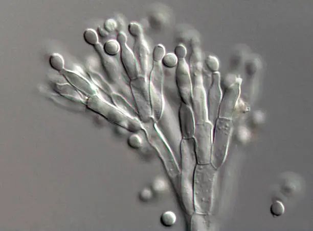 High scale magnification of a Penicillium species fungus. At the end of the long conidiophore are the phialides that form the spores. Some species of Penicillium are used in cheese making, others produce the antibiotic penicillin.