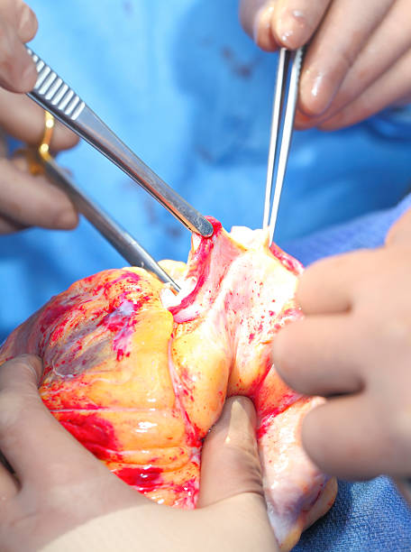 istock Preparing for heart transplantation 519403895