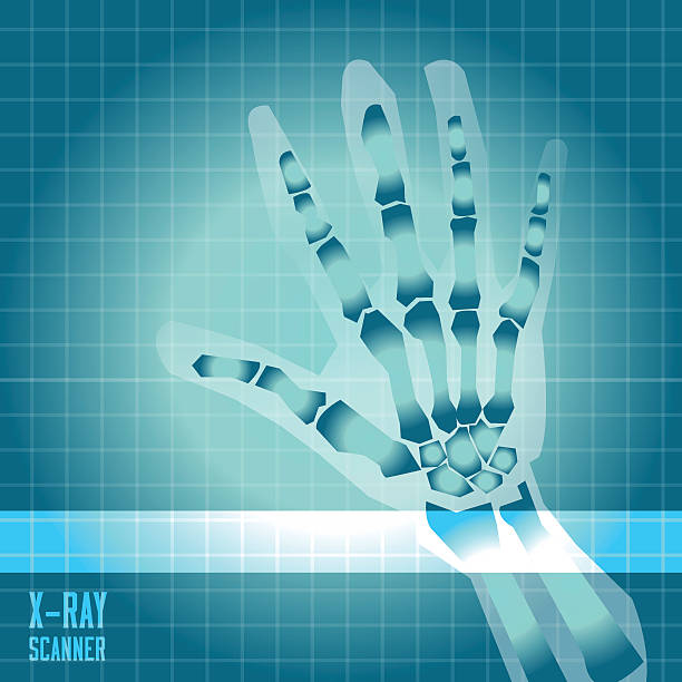 ilustrações, clipart, desenhos animados e ícones de x-ray mão de homem com scanner de luz-ilustração vetorial - medical equipment mri scanner mri scan hospital