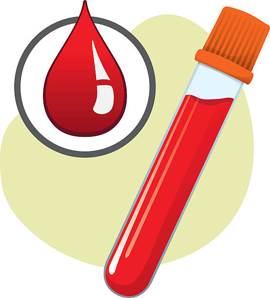 ilustraciones, imágenes clip art, dibujos animados e iconos de stock de vial con sangre obtenida para la evaluación - retrovirus hiv sexually transmitted disease aids