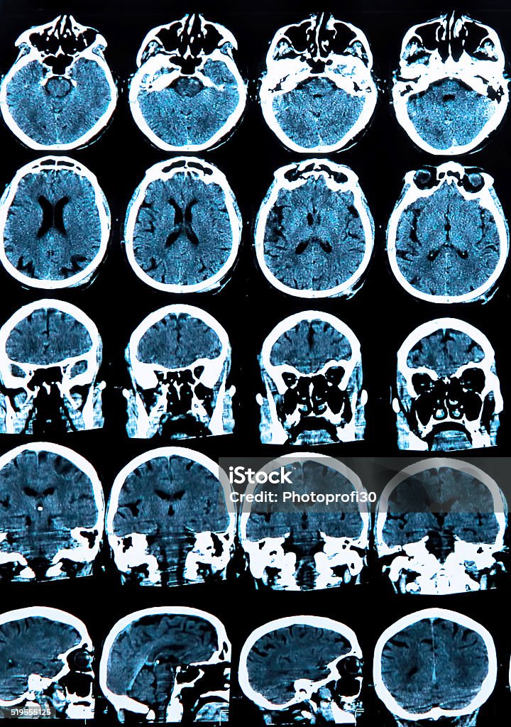 Cerveau Scanner à résonance magnétique - Photo de Anatomie libre de droits