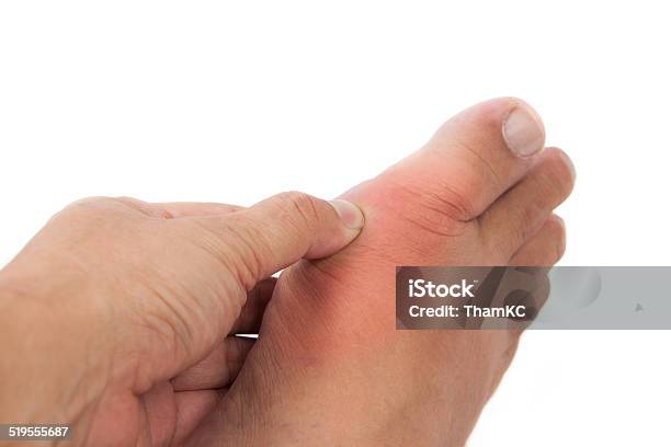 Hand Pressing On Foot Inflammed With Gout Stock Photo - Download Image Now - Gout, Human Foot, Arthritis