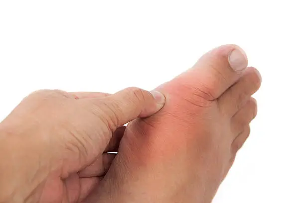 Hand pressing on the part of the foot inflammed with gout.