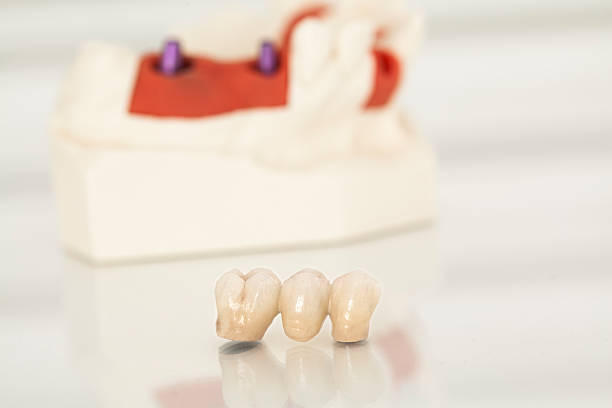 istock Metal free ceramic dental crowns 519574352
