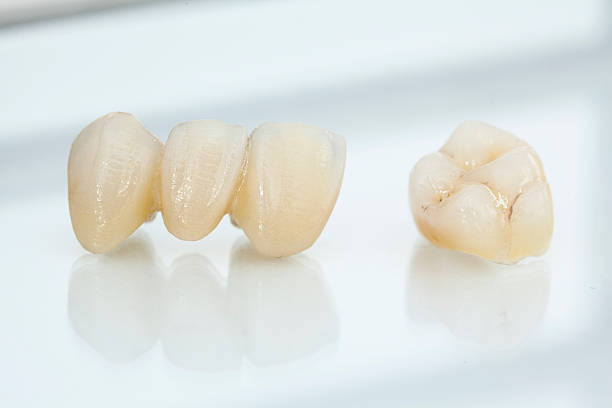 istock Metal free ceramic dental crowns 519574562