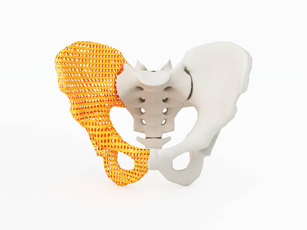 3d printed hip bone 3d printed hip bone. 3d printed implants on white background. prosthetic equipment photos stock pictures, royalty-free photos & images