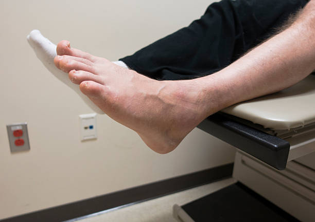 quebrado pé, torcido tornozelo, fraturei osso na sala de exame médico - podiatrist podiatry orthopedic surgeon human foot - fotografias e filmes do acervo