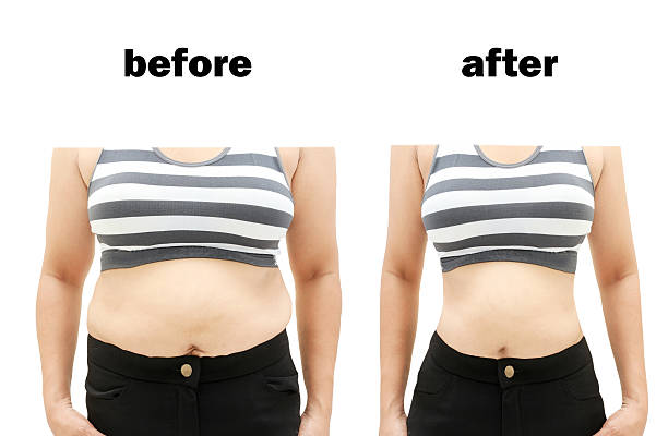 after a diet Woman's body before and after a diet before and after weight loss stock pictures, royalty-free photos & images