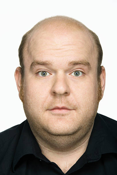 istock Man, portrait, close-up 519911415