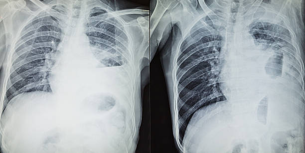 istock x-ray results in hospital 520090268