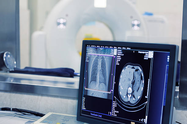 ct de escáner de un hospital - mri scanner medical scan cat scan oncology fotografías e imágenes de stock