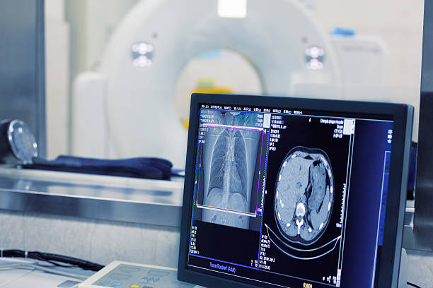 ct de escáner de un hospital - tomografía fotografías e imágenes de stock