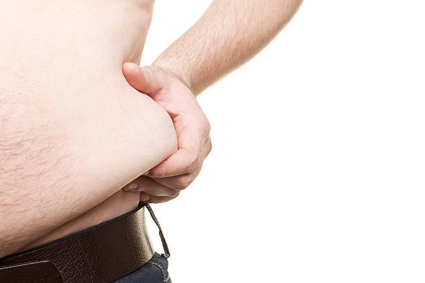 fett mann - overweight tummy tuck abdomen body stock-fotos und bilder