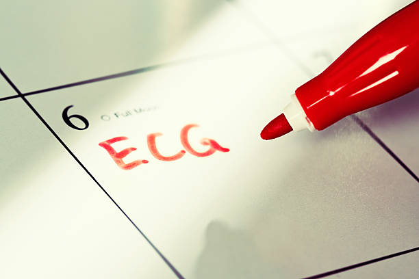 istock Calendar has ECG, for electrocardiogram, appointment marked in red 520190767