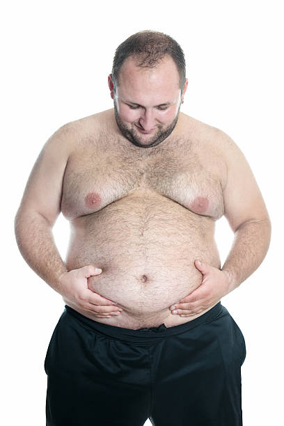 istock Overweight or Fat Shirtless Man Showing his Belly 520197509