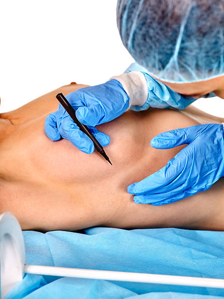 Doctor makes dotted line on female breast . Breast augmentation stock photo