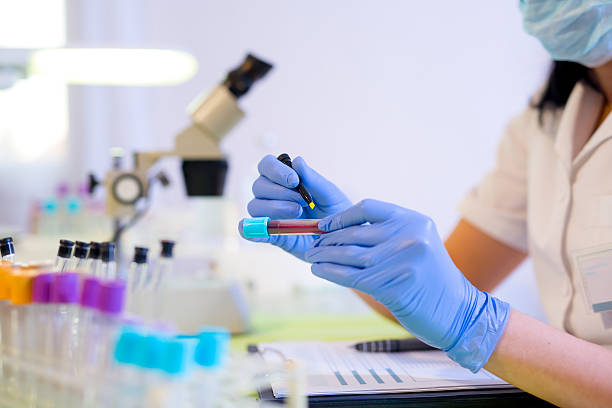 femme travaillant dans un laboratoire, écrire avec un stylo feutre. - blood sample photos et images de collection