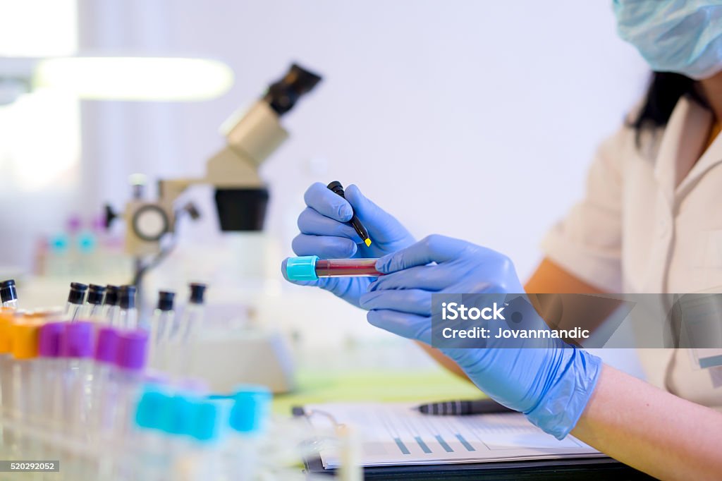 Woman working in a laboratory, writing with a felt pen. Woman working in a laboratory. He writes with a felt pen. Selective focus Blood Test Stock Photo