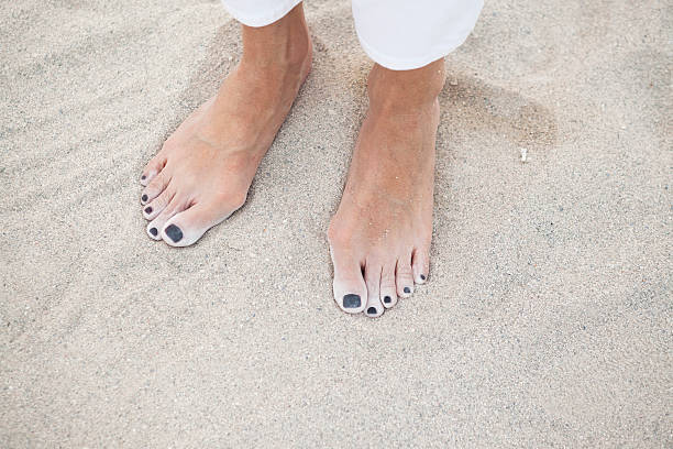A woman with bunions or crooked big toe is standing barefoot in the sand.