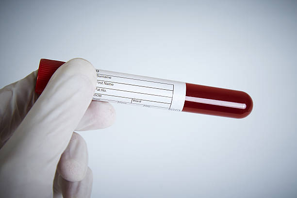 лаборатория запросу - blood blood sample blood donation tube стоковые фото и изображения