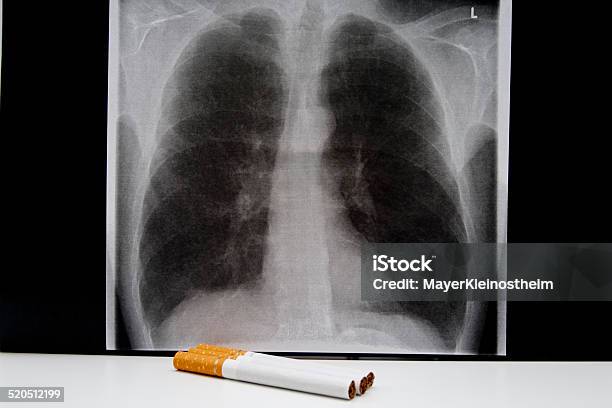 Cigarettes With Lungs Figure Stock Photo - Download Image Now - Chronic Obstructive Pulmonary Disease, Cigarette, Horizontal