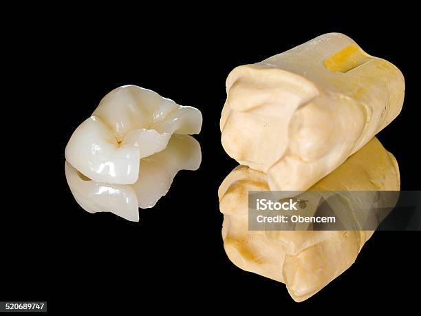 Keramikmittelsohle Stockfoto und mehr Bilder von Einlegearbeit - Einlegearbeit, Zahnpflege, Gipsgestein