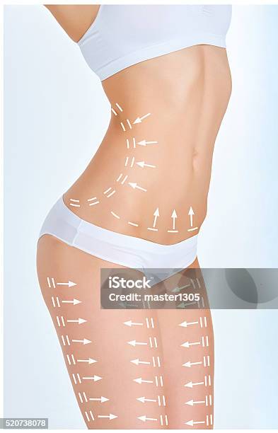 The Cellulite Removal Plan White Markings On Young Woman Body Stock Photo - Download Image Now