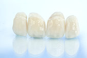 kostenlose-keramik-dental-kronen-aus-metall.jpg?b=1&s=170x170&k=20&c=lmk33D6deFB9xhBjEJGokv6z1k0u2c88nYg12XoLBlU=