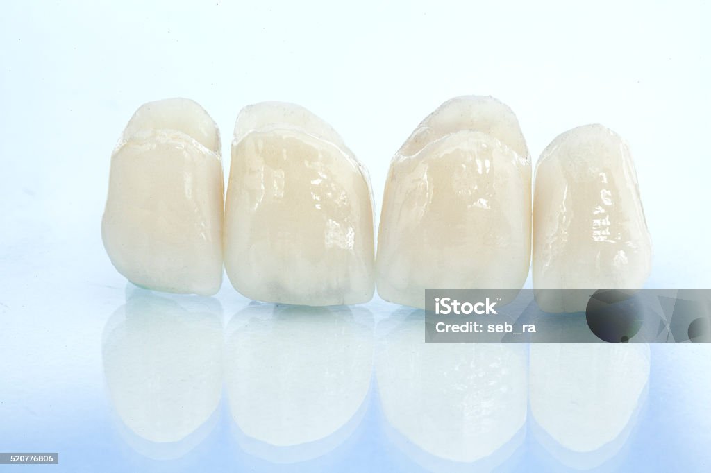 Kostenlose Keramik Dental Kronen aus Metall - Lizenzfrei Keramik Stock-Foto