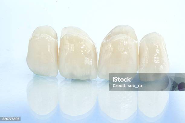 Kostenlose Keramik Dental Kronen Aus Metall Stockfoto und mehr Bilder von Keramik - Keramik, Veneer - Zahnbehandlung, Zahnpflege