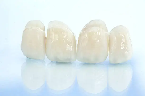 Photo of Metal free ceramic dental crowns