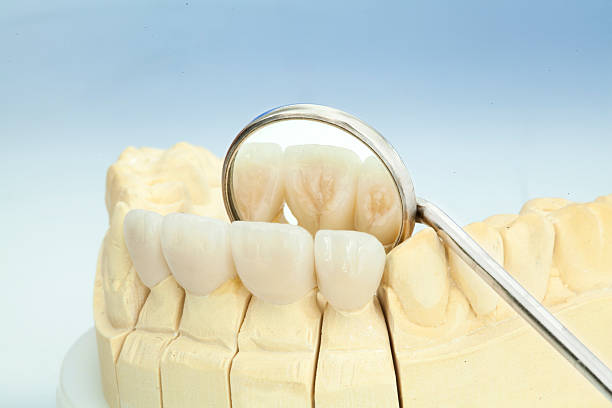 istock Metal free ceramic dental crowns 520778518