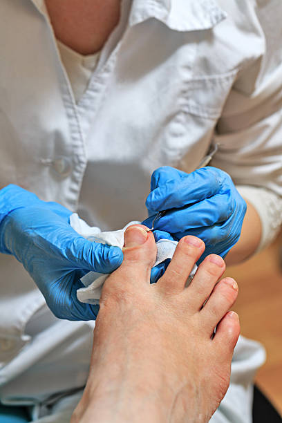 fußpflege - podiatry chiropody toenail human foot stock-fotos und bilder